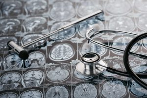 diagnostic criteria for TBI