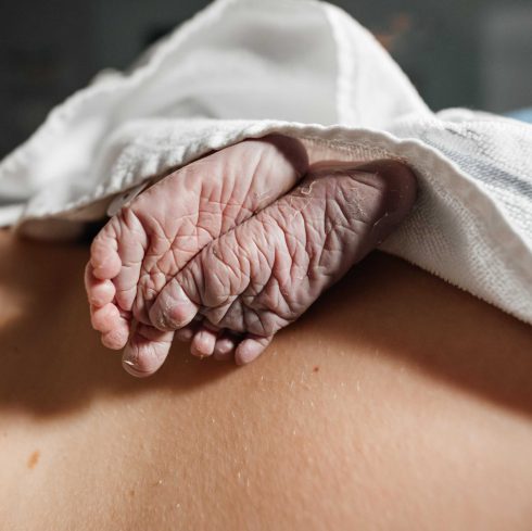 birth injuries medical malpractice